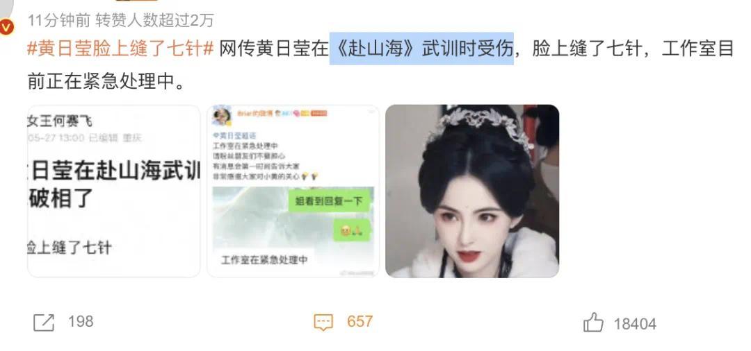 “天哪，她和李若彤超像的！30岁女演员武训时不小心受伤，脸上缝了7针”