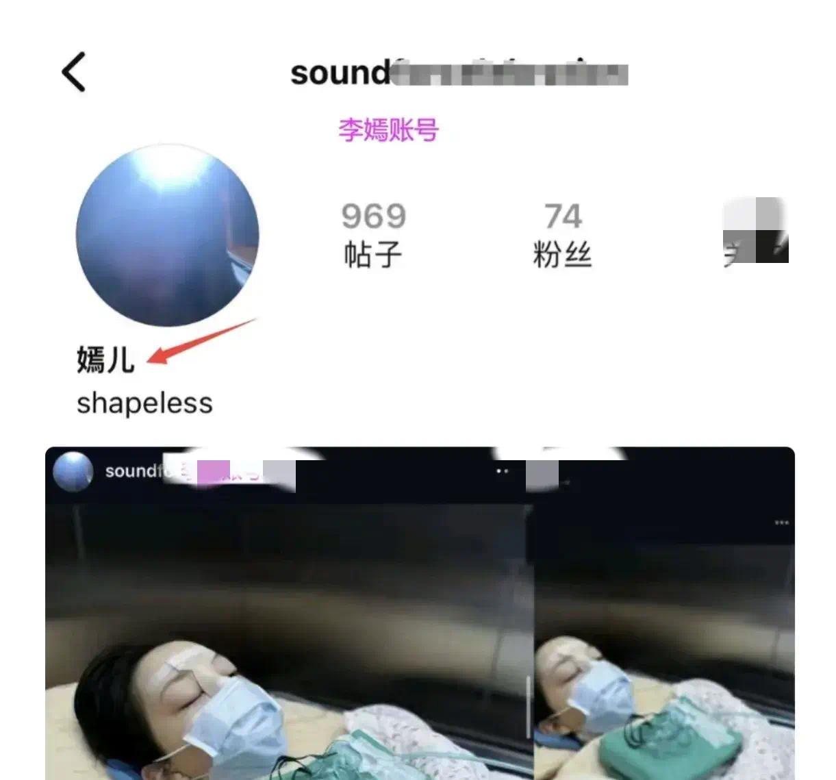 天后王菲宝贝女儿疑似再上手术台，术后照曝光，满脸纱布让人心疼不已